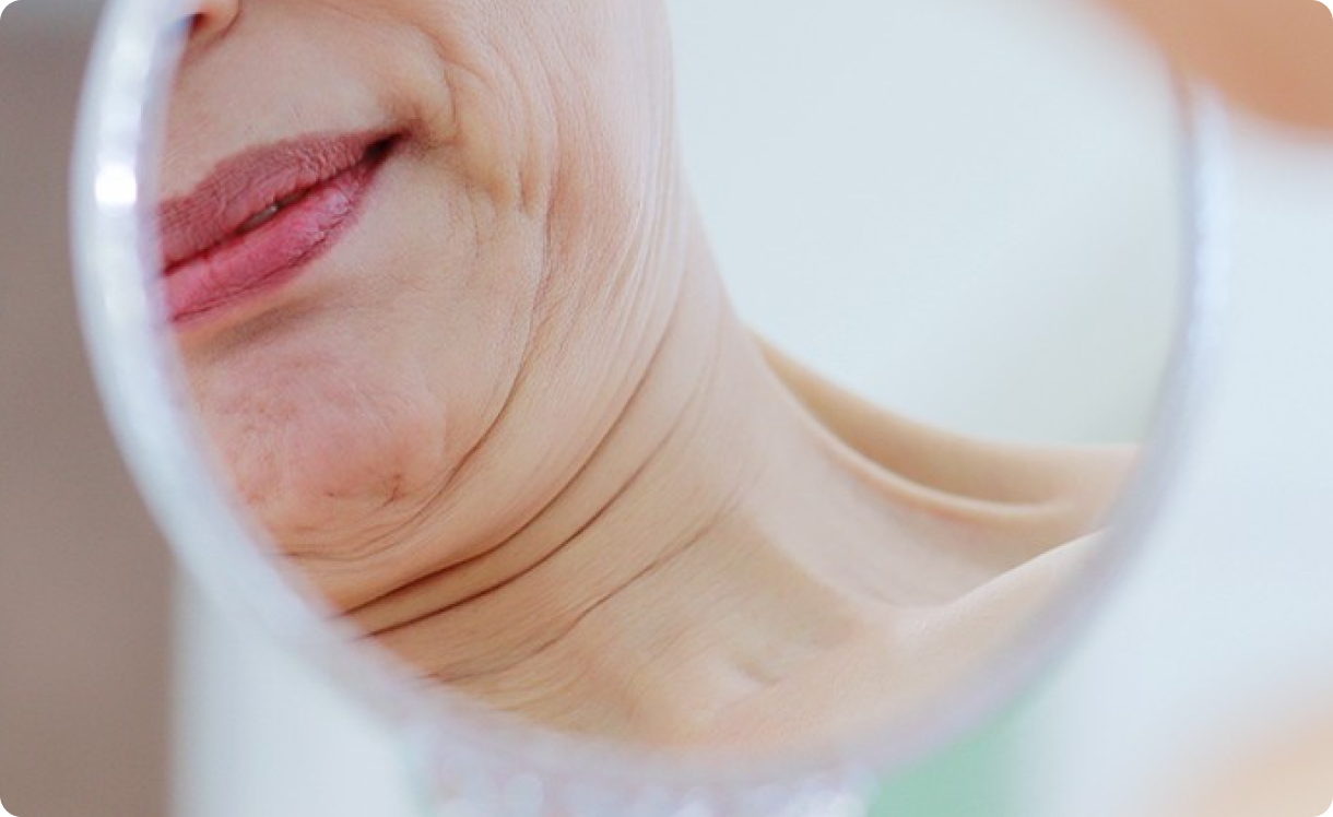 목 주름과 이중턱 이미지