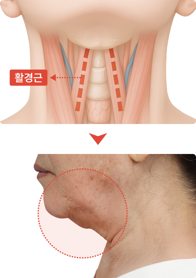 나이든 목 이미지