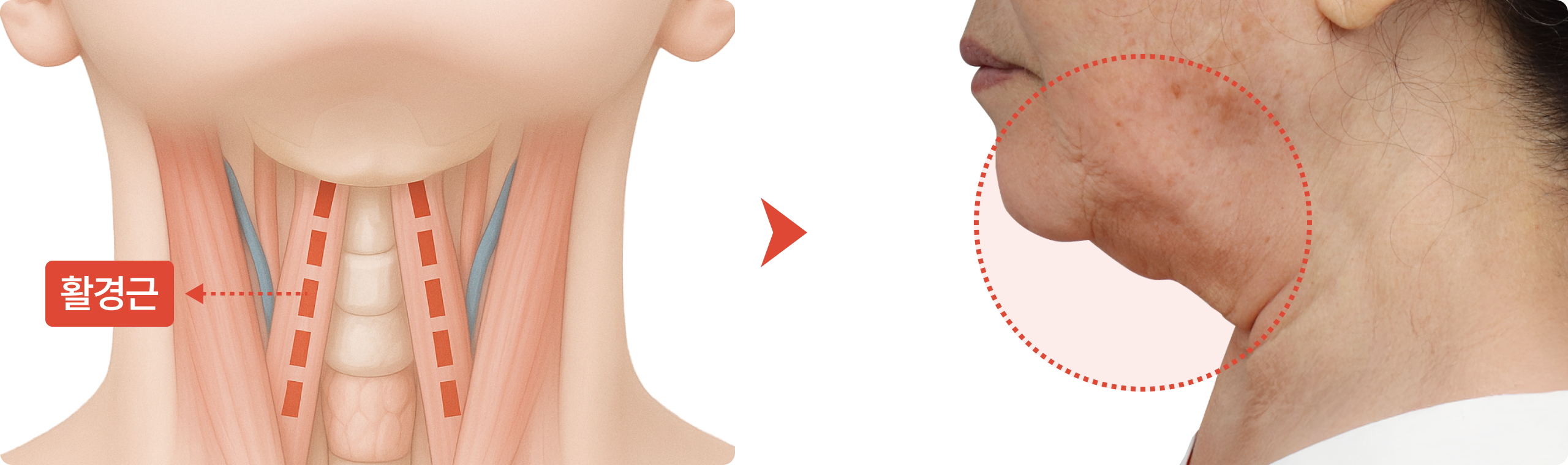 나이든 목 이미지