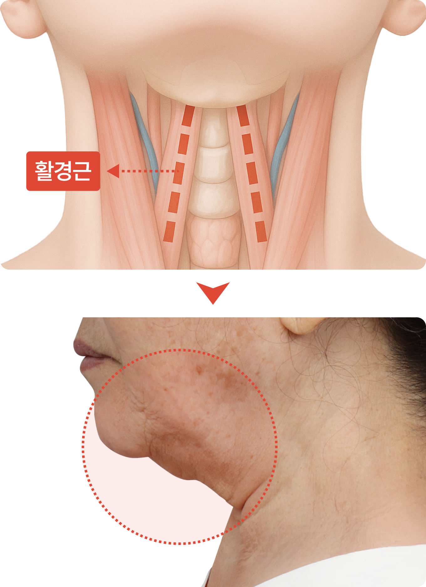 나이든 목 이미지