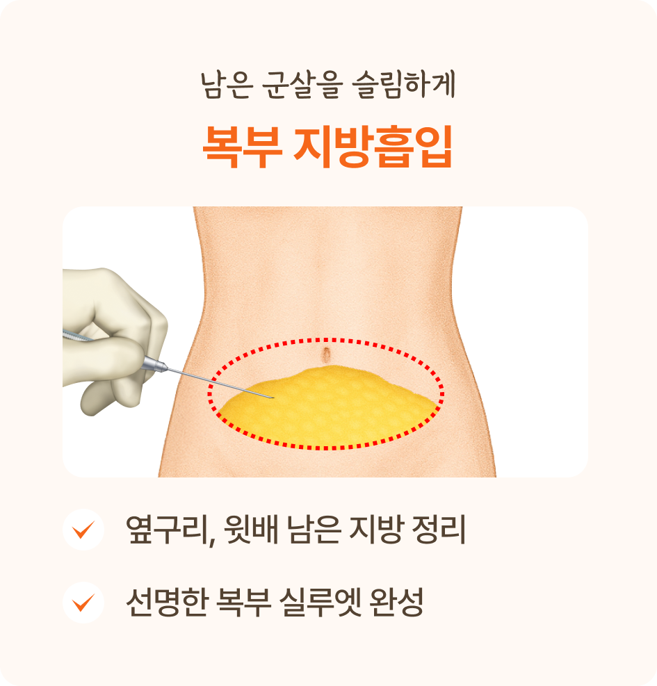 복부 지방흡입