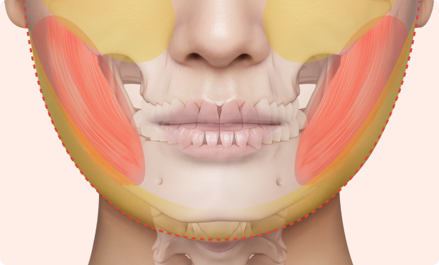 윤곽 수술, 반드시 뼈를 깎는 수술만이 답은 아닙니다.