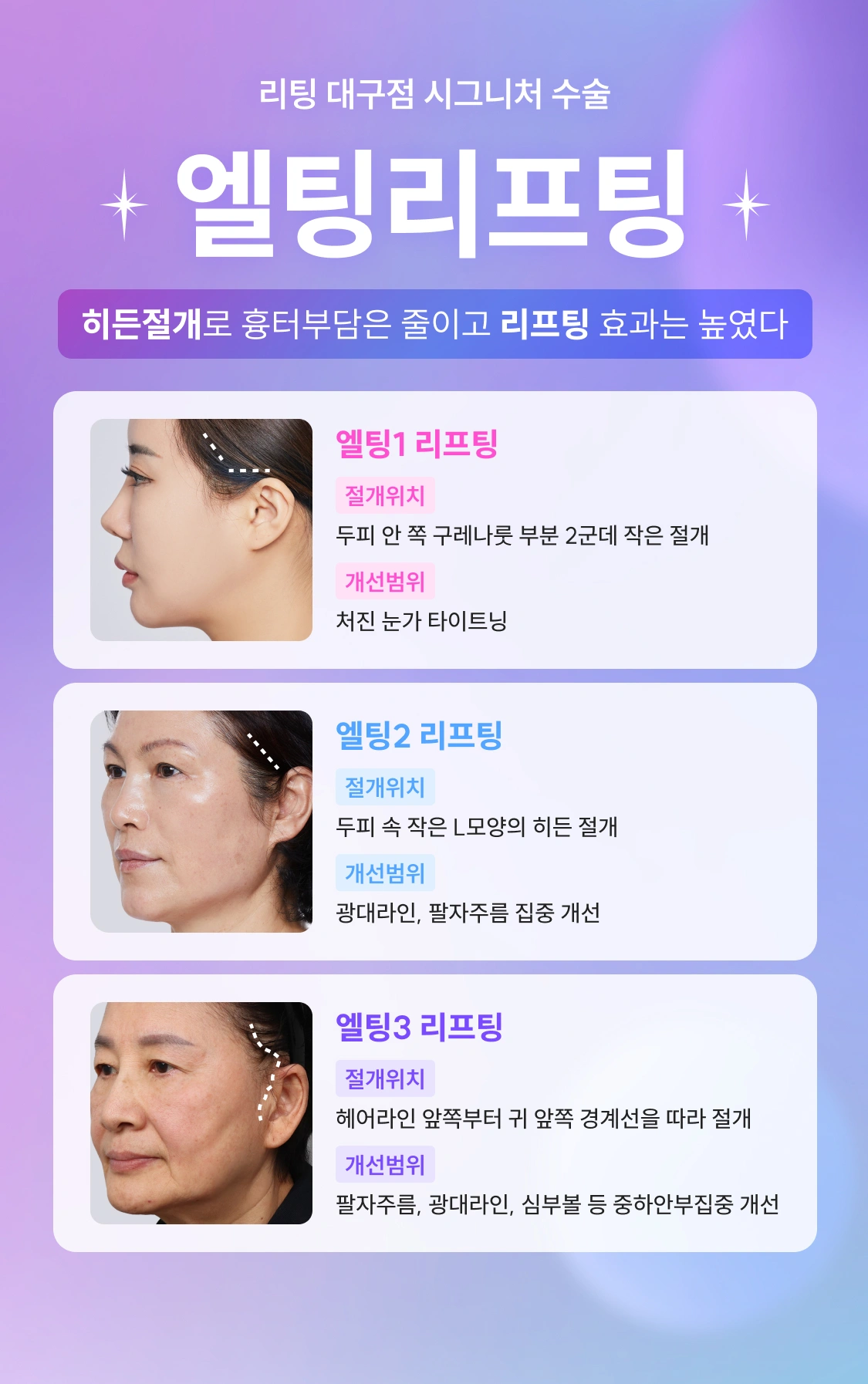 리팅 대구점 시그니처 수술 엘팅리프팅